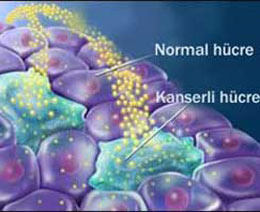 Yoksa kanserin tedavisi bulundu mu?